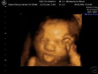 4D ULTRASOUND PICTURES 28 34 WEEKS items in WINDOW TO THE WOMB 4D BABY 