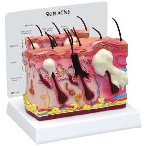  Anatomical Skin Normal Acne Two Sided Model Health 