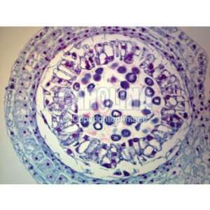 Lily Anther, Late Prophase of Meiosis, c.s. Microscope Slide, 12 u 