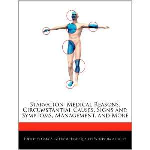   and Symptoms, Management, and More (9781276191104) Gaby Alez Books