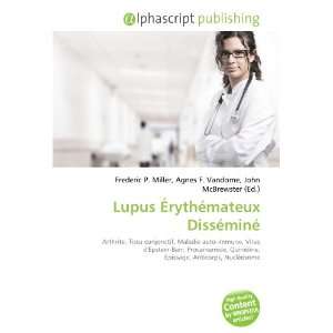  Lupus Érythémateux Disséminé (French Edition 