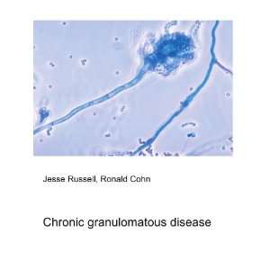  Chronic granulomatous disease Ronald Cohn Jesse Russell 
